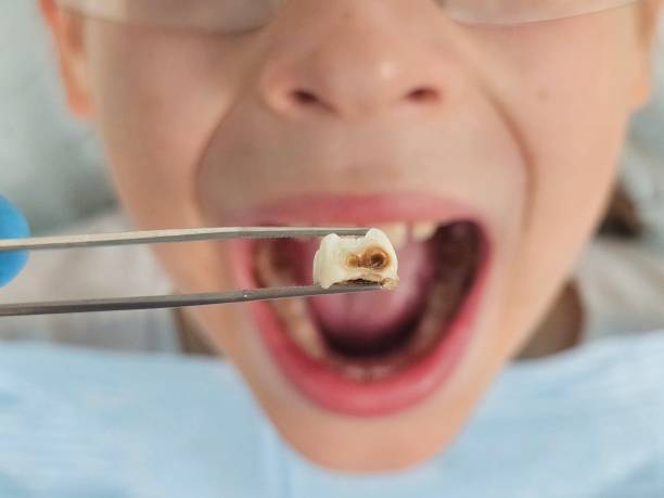  East Brady, PA Emergency Dentist Pros